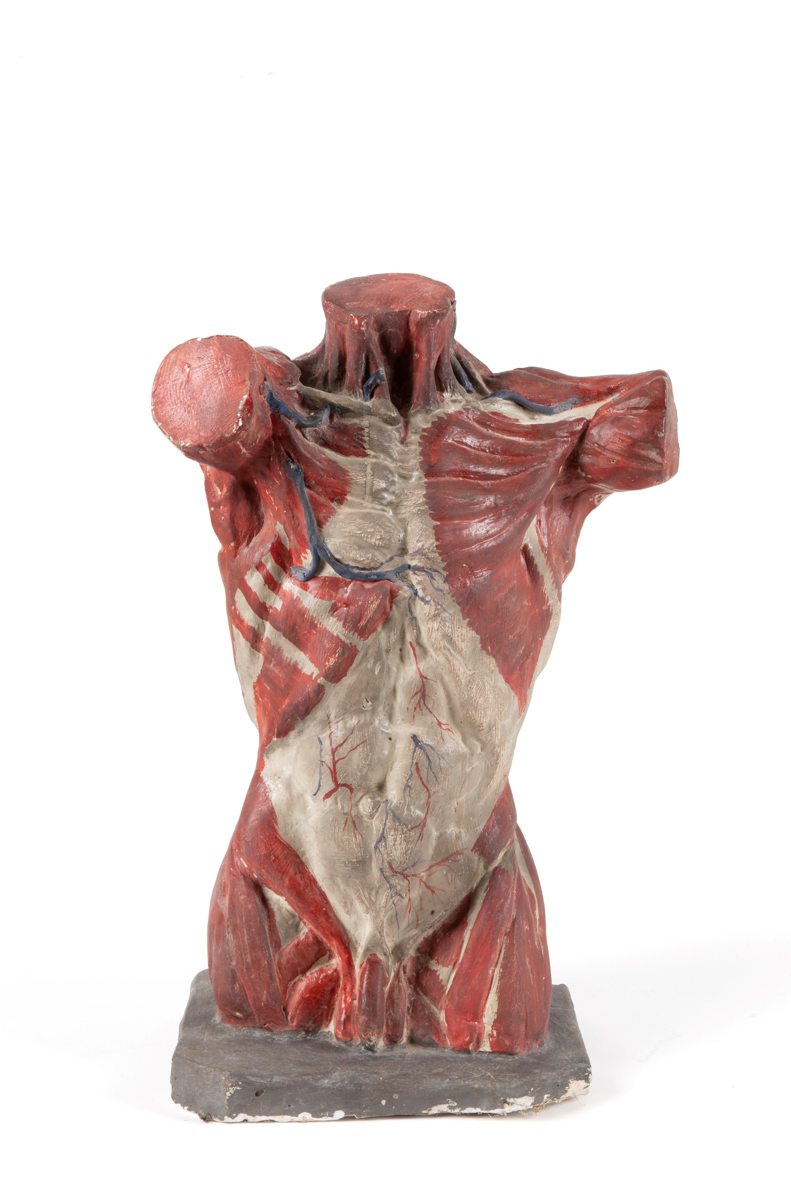Busto anatomico in gesso, con custodia originale